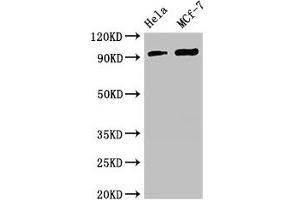 Western Blot Positive WB detected in: Hela whole cell lysate, MCF-7 whole cell lysate All lanes: TTC27 antibody at 2. (TTC27 抗体  (AA 590-817))