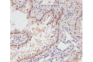 Immunohistochemistry of paraffin-embedded Rat lung using Phospho-PEA15(S104) Polyclonal Antibody at dilution of 1:100 (40x lens). (PEA15 抗体  (pSer104))