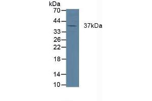 Detection of CTSK in Porcine Heart Tissue using Polyclonal Antibody to Cathepsin K (CTSK) (Cathepsin K 抗体  (AA 54-317))