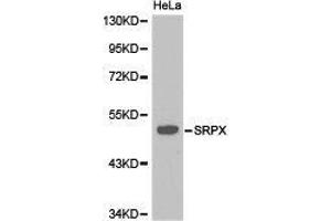 Western Blotting (WB) image for anti-Sushi-Repeat Containing Protein, X-Linked (SRPX) antibody (ABIN1874945) (SRPX 抗体)
