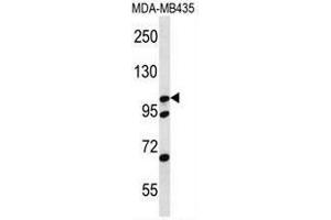 CTNND2 Antibody (C-term) western blot analysis in MDA-MB435 cell line lysates (35µg/lane). (CTNND2 抗体  (C-Term))