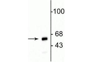 Western blot of HeLa cell lysate showing specific immunolabeling of the ~ 60 kDa mitochondrial protein. (Mitochondria 抗体)