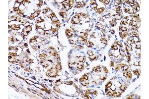 Immunohistochemistry (Paraffin-embedded Sections) (IHC (p)) image for anti-Actin, beta (ACTB) antibody (ABIN3020544)