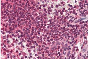 Human Spleen (formalin-fixed, paraffin-embedded) stained with RYBP antibody ABIN214470 at 2. (RYBP 抗体  (AA 215-228))