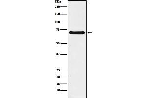 Western blot analysis of p60 CAF1 expression in Caco2 cell lysate. (Recombinant CHAF1B 抗体)
