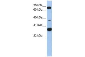 C1ORF110 antibody used at 1 ug/ml to detect target protein. (C1ORF110 抗体  (N-Term))