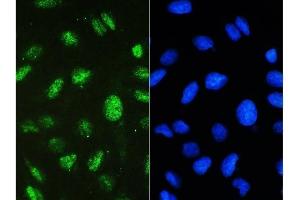 IF analysis of STAT1 using anti-STAT1 antibody (ABIN5518871) STAT1 was detected in immunocytochemical section of U20S cell.