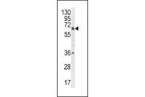 Western Blotting (WB) image for anti-Cytochrome P450, Family 2, Subfamily C, Polypeptide 18 (CYP2C18) (AA 448-478), (C-Term) antibody (ABIN652672)