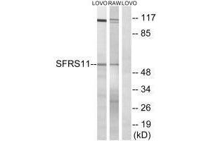 Western blot analysis of extracts from LOVO cells and RAW264. (SRSF11 抗体)