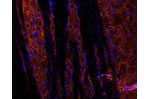Immunohistochemistry (IHC) image for anti-Glial Cell Line Derived Neurotrophic Factor (GDNF) (AA 192-207), (Mature) antibody (ABIN7043216)