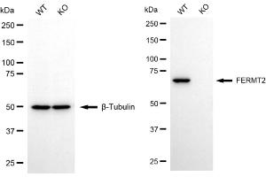 Western blotting analysis using FERMT2 antibody (ABIN7798593). (FERMT2 抗体)