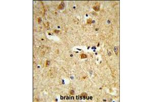 Formalin-fixed and paraffin-embedded human brain tissue reacted with DOLK Antibody , which was peroxidase-conjugated to the secondary antibody, followed by DAB staining. (Dolichol Kinase 抗体  (AA 312-339))