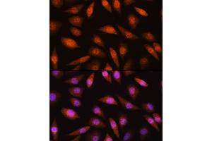 Immunofluorescence analysis of L929 cells using LIMK2 Rabbit pAb (ABIN6128187, ABIN6143230, ABIN6143231 and ABIN6221057) at dilution of 1:100 (40x lens). (LIMK2 抗体  (AA 1-240))