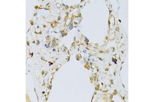 Immunohistochemistry of paraffin-embedded human lung using RPL13 antibody (ABIN1682571, ABIN5664631, ABIN5664633 and ABIN6220492) at dilution of 1:100 (40x lens). (RPL13 抗体  (AA 1-211))