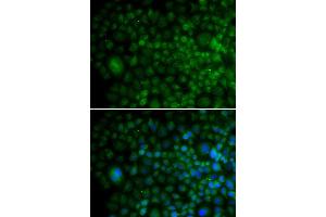 Immunofluorescence analysis of U20S cell using ANG antibody. (ANG 抗体)