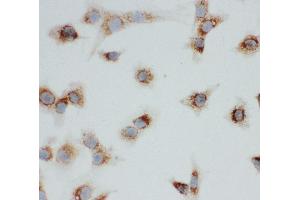 Anti-VDAC/Porin antibody, ICC ICC: NIH3T3 Cell (VDAC1 抗体  (Middle Region))
