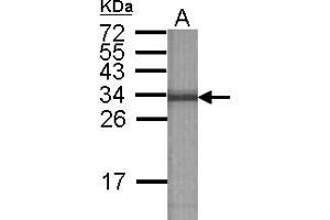 Image no. 2 for anti-ATPase, H+ Transporting, Lysosomal 31kDa, V1 Subunit E2 (ATP6V1E2) antibody (ABIN1502161) (ATP6V1E2 抗体)