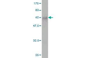 Western Blot detection against Immunogen (58. (FBXO22 抗体  (AA 1-299))