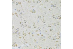 Immunohistochemistry of paraffin-embedded rat brain using RPL13 antibody (ABIN1682571, ABIN5664631, ABIN5664633 and ABIN6220492) at dilution of 1:100 (40x lens). (RPL13 抗体  (AA 1-211))