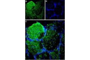 Expression of Piezo1 in rat olfactory bulb - Immunohistochemical staining of rat olfactory bulb sections using Anti-Piezo1 Antibody (ABIN7043434, ABIN7044988 and ABIN7044989).