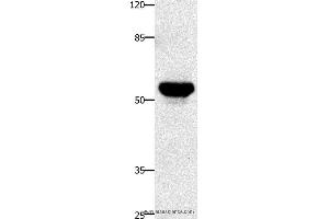 Western blot analysis of Human fetal brain tissue, using TNFRSF21 Polyclonal Antibody at dilution of 1:420 (TNFRSF21 抗体)