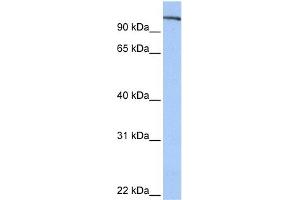 WB Suggested Anti-FES Antibody Titration: 0. (FES 抗体  (N-Term))
