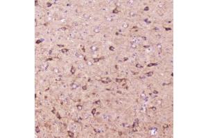 IHC testing of FFPE mouse brain tissue with IGFBP2 antibody at 2ug/ml. (IGFBP2 抗体  (AA 35-304))