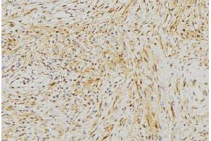 ABIN6272968 at 1/100 staining Mouse muscle tissue by IHC-P. (NLRX1 抗体  (Internal Region))