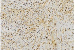 ABIN6272968 at 1/100 staining Mouse muscle tissue by IHC-P. (NLRX1 抗体  (Internal Region))