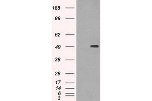 Image no. 1 for anti-Tubulin, beta 3 (TUBB3) (AA 1-150) antibody (ABIN1490580) (TUBB3 抗体  (AA 1-150))