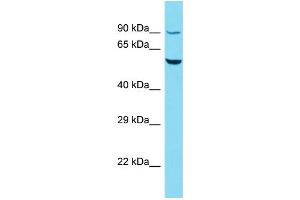 Host: Rabbit Target Name: R3HCC1L Sample Type: HepG2 Whole Cell lysates Antibody Dilution: 1. (GIDRP88 抗体  (C-Term))
