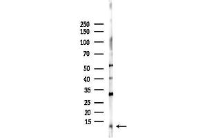 anti-Chemokine (C-X-C Motif) Ligand 3 (CXCL3) (C-Term) antibody