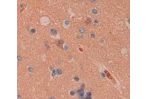 IHC-P analysis of Human Tissue, with DAB staining. (Peroxiredoxin 4 抗体  (AA 6-249))