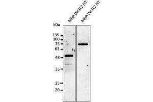 Western Blotting (WB) image for anti-DIS3-Like Exonuclease 2 (DIS3L2) (N-Term) antibody (ABIN7272981) (DIS3L2 抗体  (N-Term))