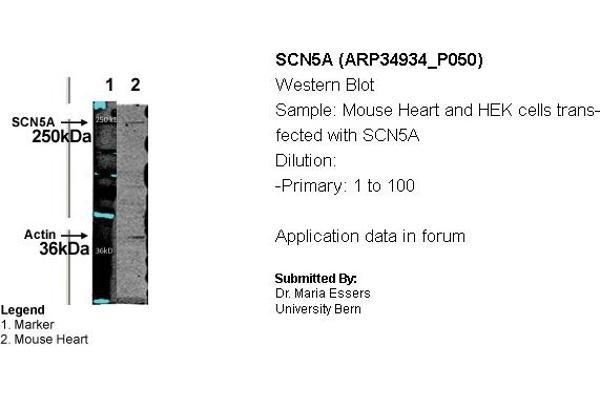 SCN5A 抗体  (N-Term)