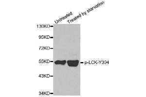 Western blot analysis of extracts from JK cells, using phospho-LCK-Y394 polyclonal antibody (ABIN2987539). (LCK 抗体  (pTyr394))