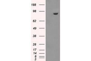 Image no. 1 for anti-Glucan (1,4-alpha-), Branching Enzyme 1 (GBE1) antibody (ABIN1498396) (GBE1 抗体)