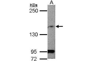 WB Image Sample (50 ug of whole cell lysate) A: mouse brain 5% SDS PAGE antibody diluted at 1:1000 (MAGI1 抗体  (C-Term))
