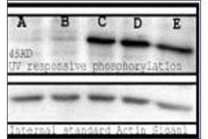 Image no. 1 for anti-Phosphoserine (phosphorylated) antibody (ABIN264875) (Phosphoserine 抗体  (phosphorylated))