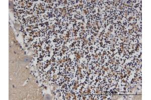 Immunoperoxidase of monoclonal antibody to PDE9A on formalin-fixed paraffin-embedded human cerebellum. (PDE9A 抗体  (AA 434-533))