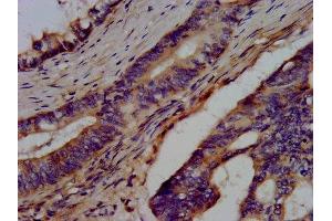 Immunohistochemistry (IHC) image for anti-BRCA1 Associated Protein (BRAP) (AA 13-124) antibody (ABIN7145758)