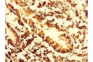Immunohistochemistry of paraffin-embedded human appendix tissue using ABIN7155576 at dilution of 1:100 (HLA-DMA 抗体  (AA 27-233))