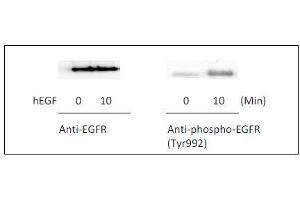 EGFR ELISA 试剂盒