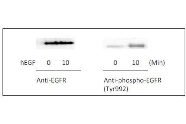 EGFR ELISA 试剂盒