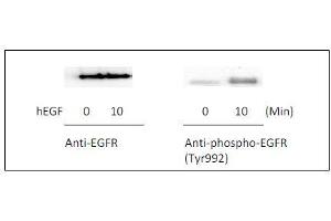 Western blot analysis of extracts from 100 ng/mL hEGF treated A431 cells. (EGFR ELISA 试剂盒)