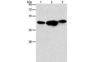 Western Blot analysis of 293T, PC3 and NIH/3T3 cell using ARFGAP1 Polyclonal Antibody at dilution of 1:850 (ARFGAP1 抗体)