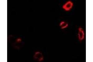 Immunofluorescent analysis of GNT1 staining in MCF7 cells. (Ugt1 抗体)