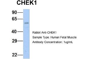Host: Rabbit Target Name: CHEK1 Sample Type: Human Fetal Muscle Antibody Dilution: 1. (CHEK1 抗体  (Middle Region))