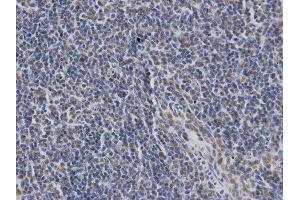 Immunohistochemistry (IHC) image for anti-Lymphocyte Cytosolic Protein 2 (SH2 Domain Containing Leukocyte Protein of 76kDa) (LCP2) antibody (ABIN1873525) (LCP2 抗体)