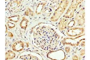 IHC image of ABIN7146841 diluted at 1:200 and staining in paraffin-embedded human kidney tissue performed on a Leica BondTM system. (CPT2 抗体  (AA 388-551))
